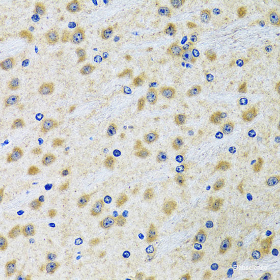 Immunohistochemistry of paraffin-embedded Mouse heart using MYOT Polyclonal Antibody at dilution of  1:100 (40x lens).