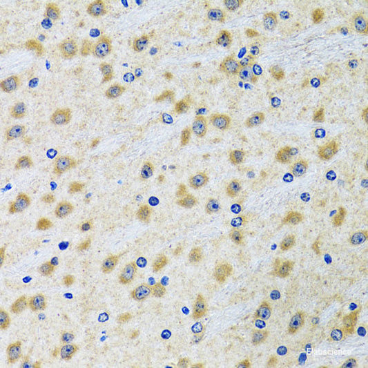 Immunohistochemistry of paraffin-embedded Mouse heart using MYOT Polyclonal Antibody at dilution of  1:100 (40x lens).