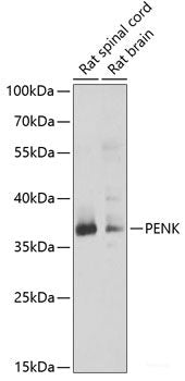 Immunohistochemistry of paraffin-embedded Rat brain using PTRH2 Polyclonal Antibody at dilution of  1:100 (40x lens).