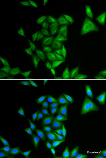 Immunofluorescence analysis of U2OS cells using MYOZ2 Polyclonal Antibody