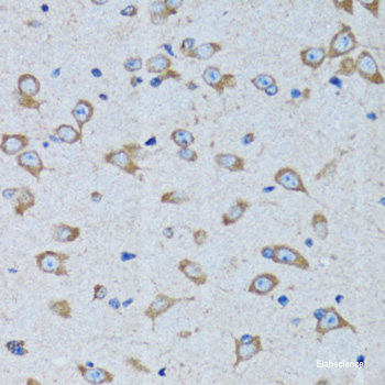 Immunohistochemistry of paraffin-embedded Human colon carcinoma using KRBOX4 Polyclonal Antibody at dilution of  1:200 (40x lens).