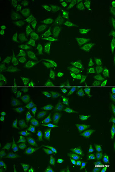 Immunohistochemistry of paraffin-embedded Rat heart using ACSS2 Polyclonal Antibody at dilution of  1:100 (40x lens).
