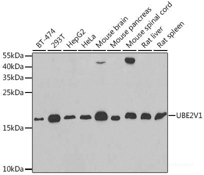 Immunohistochemistry of paraffin-embedded Rat kidney using CYP20A1 Polyclonal Antibody at dilution of  1:200 (40x lens).