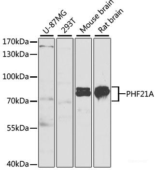 Immunohistochemistry of paraffin-embedded Mouse heart using UCN2 Polyclonal Antibody at dilution of  1:100 (40x lens).