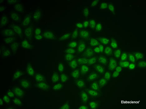 Immunohistochemistry of paraffin-embedded Mouse brain using AKAP5 Polyclonal Antibody at dilution of  1:100 (40x lens).
