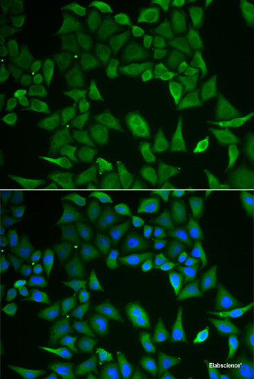 Immunofluorescence analysis of A549 cells using ANLN Polyclonal Antibody