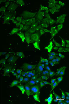 Immunohistochemistry of paraffin-embedded Mouse lung using BHLHE40 Polyclonal Antibody at dilution of  1:100 (40x lens).