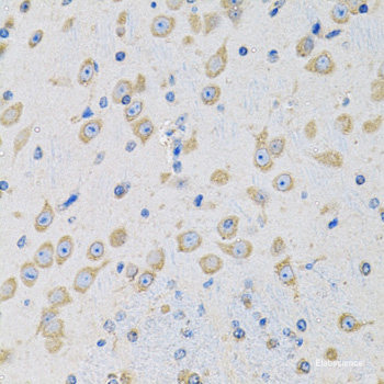 Immunohistochemistry of paraffin-embedded Human liver using CCM2 Polyclonal Antibody at dilution of  1:100 (40x lens).