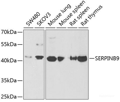 Immunohistochemistry of paraffin-embedded Mouse heart using CCT3 Polyclonal Antibody at dilution of  1:100 (40x lens).