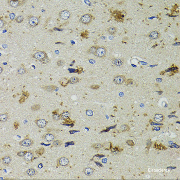 Immunohistochemistry of paraffin-embedded Human oophoroma using CENPC Polyclonal Antibody at dilution of  1:200 (40x lens).