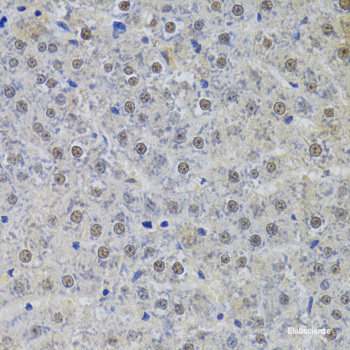 Immunohistochemistry of paraffin-embedded Rat heart using CRHBP Polyclonal Antibody at dilution of  1:100 (40x lens).