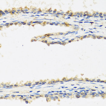Immunohistochemistry of paraffin-embedded Rat brain using CSRP3 Polyclonal Antibody at dilution of  1:100 (40x lens).
