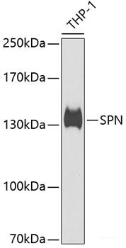Immunohistochemistry of paraffin-embedded Rat brain using CST1 Polyclonal Antibody at dilution of  1:100 (40x lens).