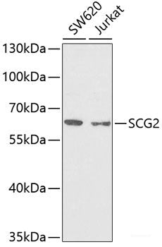 Immunohistochemistry of paraffin-embedded Human tonsil using FCN1 Polyclonal Antibody at dilution of  1:100 (40x lens).