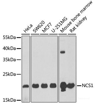 Immunohistochemistry of paraffin-embedded Mouse stomach using HPS1 Polyclonal Antibody at dilution of  1:100 (40x lens).