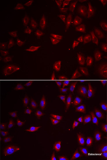 Immunohistochemistry of paraffin-embedded Rat spleen using HSPH1 Polyclonal Antibody at dilution of  1:100 (40x lens).