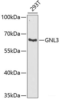 Immunohistochemistry of paraffin-embedded Human tonsil using HYOU1 Polyclonal Antibody at dilution of  1:100 (40x lens).