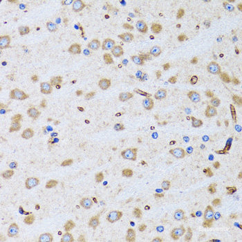 Immunohistochemistry of paraffin-embedded Rat liver using INPP5J Polyclonal Antibody at dilution of  1:100 (40x lens).
