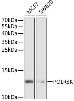 Immunohistochemistry of paraffin-embedded Human breast cancer using INTS6 Polyclonal Antibody at dilution of  1:100 (40x lens).