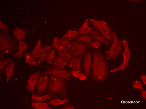 Immunohistochemistry of paraffin-embedded Mouse brain using KLK11 Polyclonal Antibody at dilution of  1:100 (40x lens).