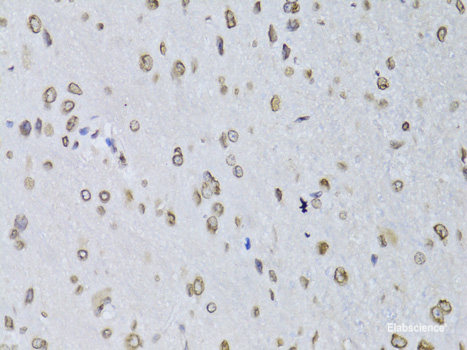 Immunohistochemistry of paraffin-embedded Rat kidney using MATK Polyclonal Antibody at dilution of  1:100 (40x lens).