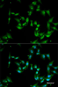Immunohistochemistry of paraffin-embedded Rat lung using MTA3 Polyclonal Antibody at dilution of  1:100 (40x lens).