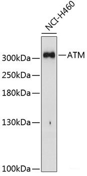 Immunohistochemistry of paraffin-embedded Rat lung using C8orf4 Polyclonal Antibody at dilution of  1:100 (40x lens).