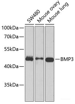 Immunohistochemistry of paraffin-embedded Human kidney cancer using DDX21 Polyclonal Antibody at dilution of  1:100 (40x lens).