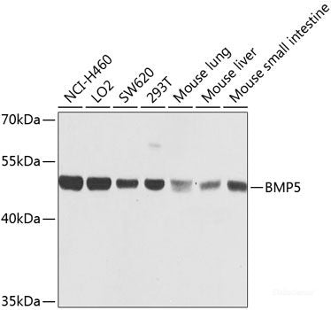 Immunohistochemistry of paraffin-embedded Human prostate using MEMO1 Polyclonal Antibody at dilution of  1:100 (40x lens).