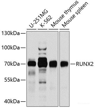 Immunofluorescence analysis of C6 cells using SETD2 Polyclonal Antibody at dilution of  1:100 (40x lens). Blue: DAPI for nuclear staining.