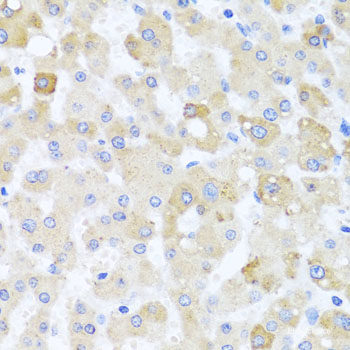 Immunohistochemistry of paraffin-embedded Human stomach using MYBBP1A Polyclonal Antibody at dilution of  1:100 (40x lens).