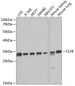 Immunohistochemistry of paraffin-embedded Human breast using BCCIP Polyclonal Antibody at dilution of  1:100 (40x lens).