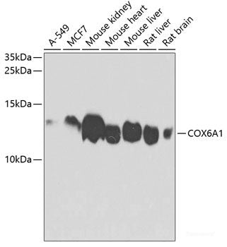 Immunohistochemistry of paraffin-embedded Rat kidney using POP4 Polyclonal Antibody at dilution of  1:100 (40x lens).