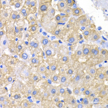 Immunohistochemistry of paraffin-embedded Rat heart using ASMT Polyclonal Antibody at dilution of  1:100 (40x lens).