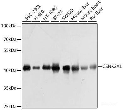 Immunohistochemistry of paraffin-embedded Rat heart using COL11A1 Polyclonal Antibody at dilution of  1:100 (40x lens).