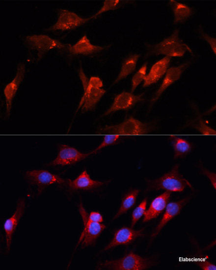 Immunofluorescence analysis of C6 cells using PLK1 Polyclonal Antibody at dilution of  1:100 (40x lens). Blue: DAPI for nuclear staining.