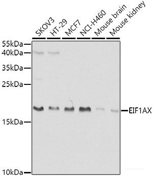 Immunohistochemistry of paraffin-embedded Rat brain using GAB1 Polyclonal Antibody at dilution of  1:100 (40x lens).