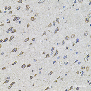 Immunohistochemistry of paraffin-embedded Mouse brain using GATA2 Polyclonal Antibody at dilution of  1:100 (40x lens).