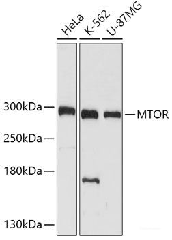 Immunohistochemistry of paraffin-embedded Human esophagus using FOSL2 Polyclonal Antibody at dilution of  1:100 (40x lens).