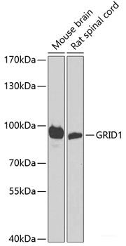 Immunohistochemistry of paraffin-embedded Human stomach using ATAD3A Polyclonal Antibody at dilution of  1:100 (40x lens).