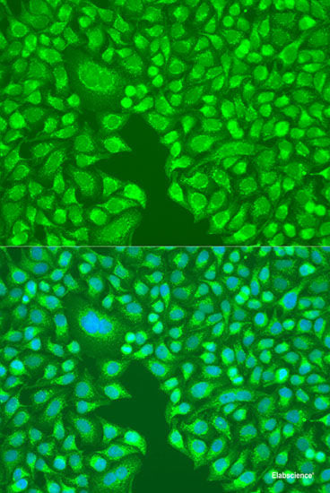 Immunofluorescence analysis of C6 cells using INPP5B Polyclonal Antibody at dilution of  1:100. Blue: DAPI for nuclear staining.