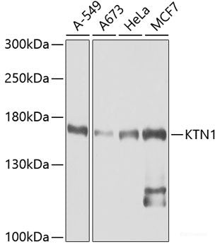 Immunohistochemistry of paraffin-embedded Mouse lung using CYP2C9 Polyclonal Antibody at dilution of  1:100 (40x lens).