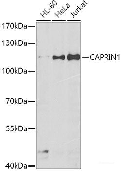 Immunohistochemistry of paraffin-embedded Rat kidney using CDH6 Polyclonal Antibody at dilution of  1:100 (40x lens).