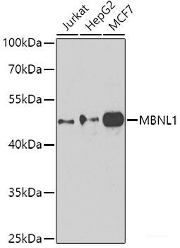 Immunohistochemistry of paraffin-embedded Human prostate using ARL6 Polyclonal Antibody at dilution of  1:100 (40x lens).