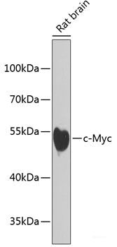 Immunohistochemistry of paraffin-embedded Rat pancreas using ETV1 Polyclonal Antibody at dilution of  1:100 (40x lens).
