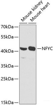 Immunohistochemistry of paraffin-embedded Human lung cancer using Phospho-Histone H3(T11) Polyclonal Antibody at dilution of  1:100 (40x lens).