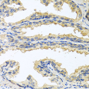 Immunohistochemistry of paraffin-embedded Rat lung using PIP Polyclonal Antibody at dilution of  1:100 (40x lens).