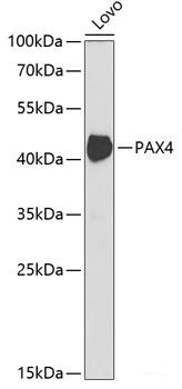 Immunofluorescence analysis of U2OS cells using RAG2 Polyclonal Antibody