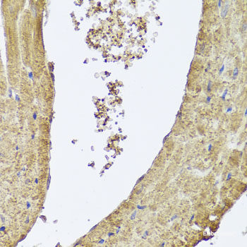 Immunofluorescence analysis of Rat brain using CORO1A Polyclonal Antibody at dilution of  1:100 (40x lens). Blue: DAPI for nuclear staining.