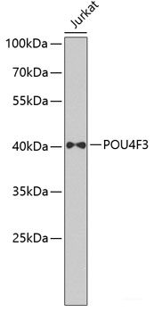 Immunohistochemistry of paraffin-embedded Human stomach using BPGM Polyclonal Antibody at dilution of  1:100 (40x lens).